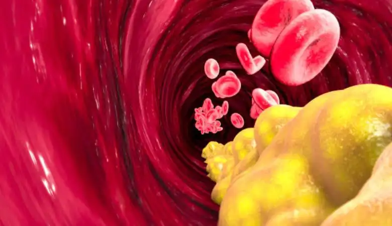 Triglycerides